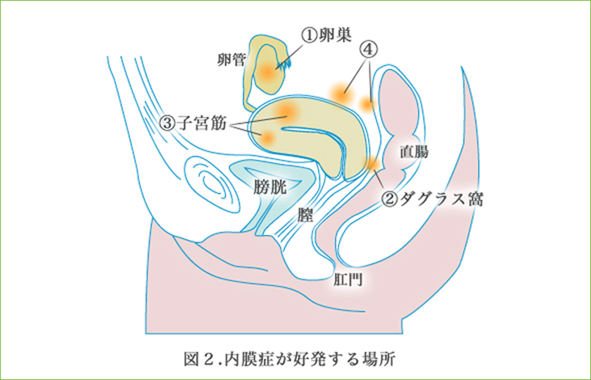 おしり 痛い 生理