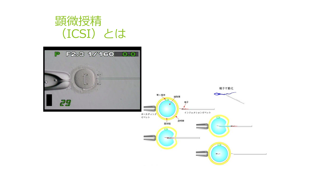 ISCIとは